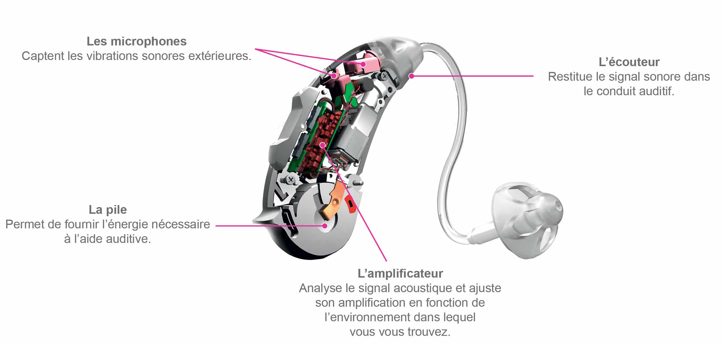 519cbb452dffcUne-aide-auditive-comment-ca-marche.jpg
